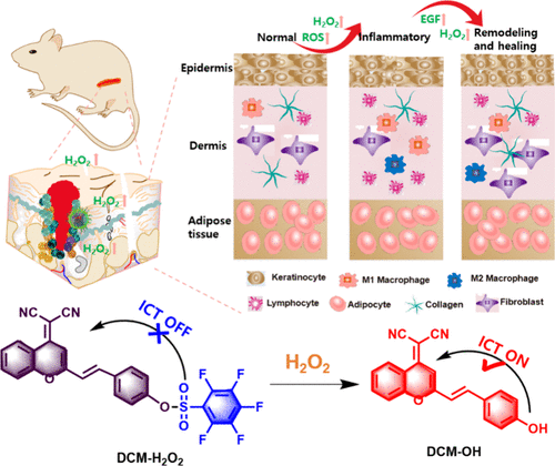 1709192374-images_medium_se3c02147_0007