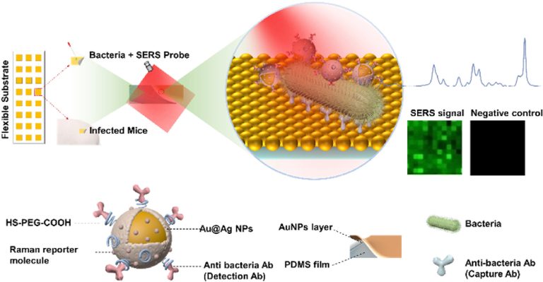 1744161693-1-s2.0-S003991402500579X-ga1_lrg